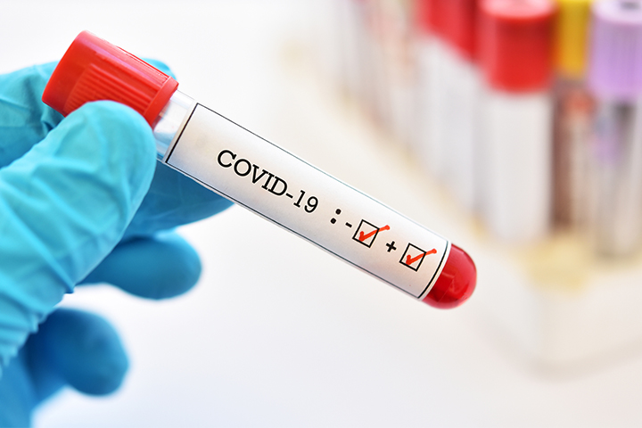 Covid-19 : 61 nouvelles infections enregistrées (ANSS)